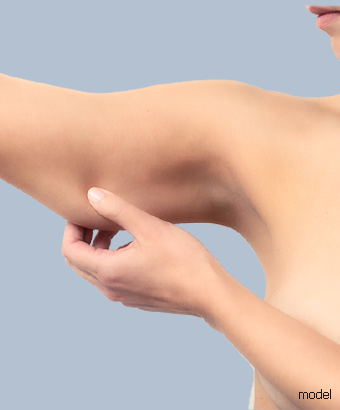 arm liposuction Beverly Hills