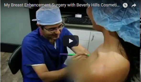 Breast enhancement surgery