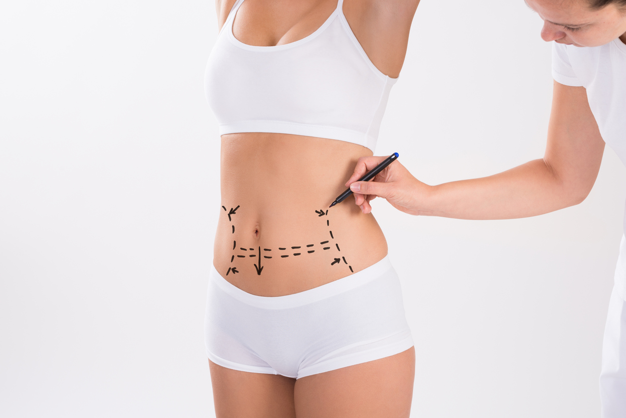 tummy tuck beverly hills