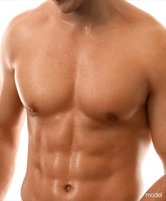 male liposuction Beverly Hills